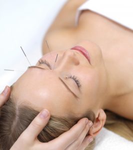 Acupuncture therapy - alternative medicine. Portrait of a beautiful woman in acupuncture therapy